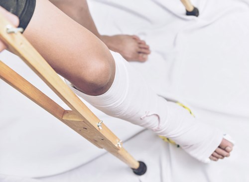 If left untreated, shin splints can progress to a stress fracture, an injury that has a longer and more-involved healing process that can require surgery.