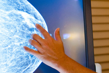 Doctor analyzing an x-ray image of a breast