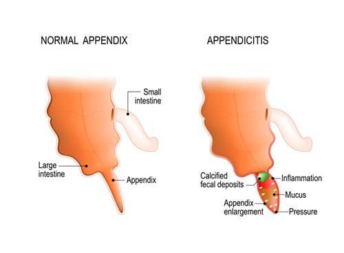 What Does The Appendix Do Inset01 ?width=500