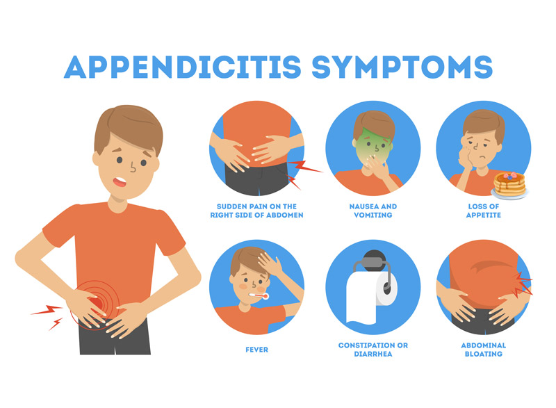 What Does The Appendix Do Other Questions About The Body S Mystery Organ   What Does The Appendix Do Inset03 