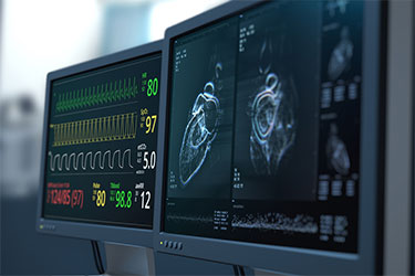 Heart monitor screen and heart imaging.