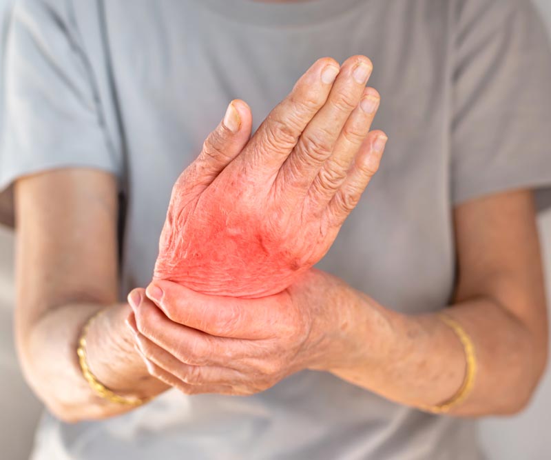 an elderly woman holds her wrist in pain