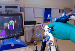 A surgeon holds the NAVIO system while looking at a diagnostic image on a computer screen